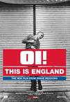 这就是英格兰 This Is England/
